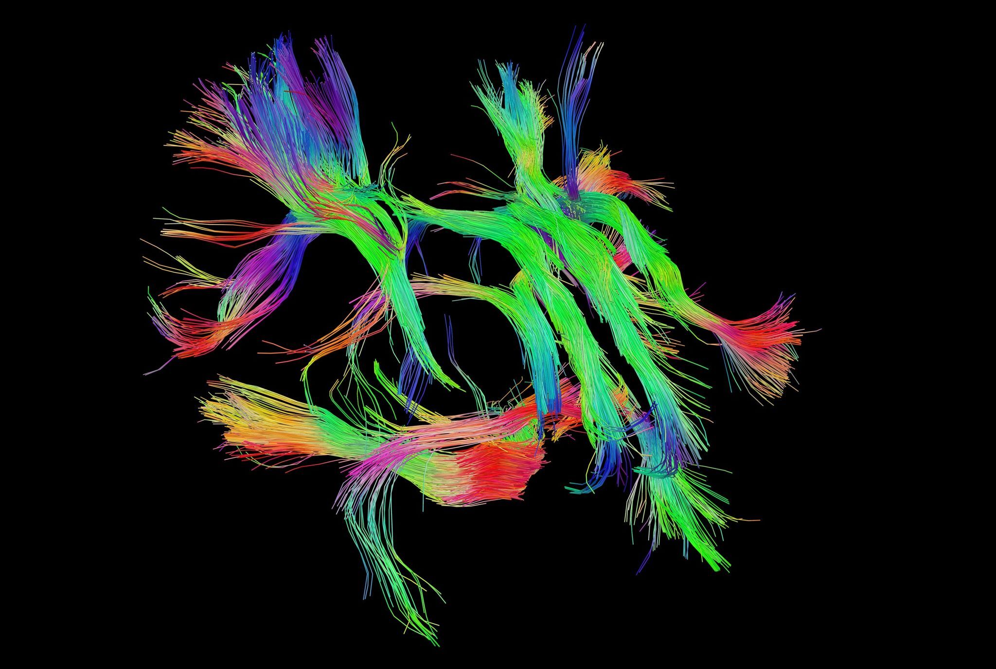 Diffusion tenor imaging